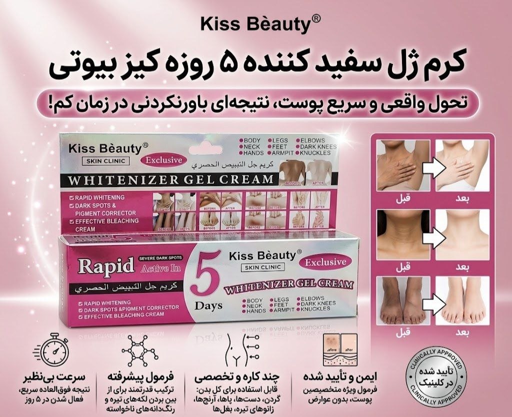 کرم سفیدکننده بدن Kiss Beauty Rapid 5 Days